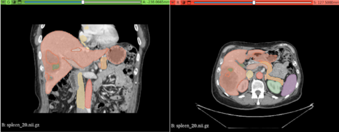 Digital AI platform for radiologists